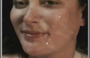XXX Xinh đẹp bị ung thư và yêu cầu ảnh